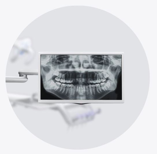 Osstem Treatment Display Monitor Arm (1.625 INCH)