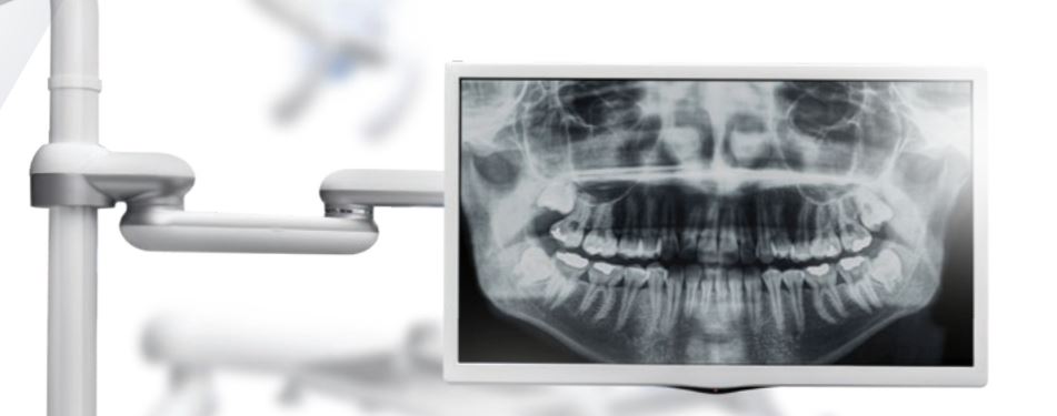 Osstem Treatment Display Monitor Arm (1.625 INCH)