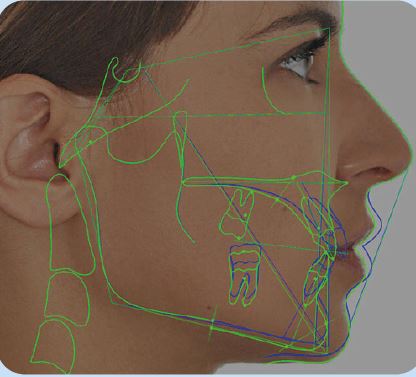 Owandy Ceph Analysis Orthodontic Software